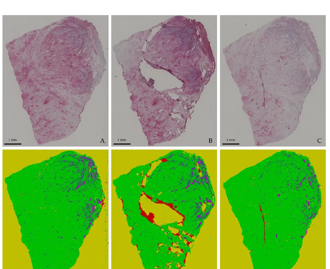 Drei histologische Gewebeschnitte (oben) und ihre automatische Segmentierung in Gefäße, Gewebe und Hintergrund (unten)