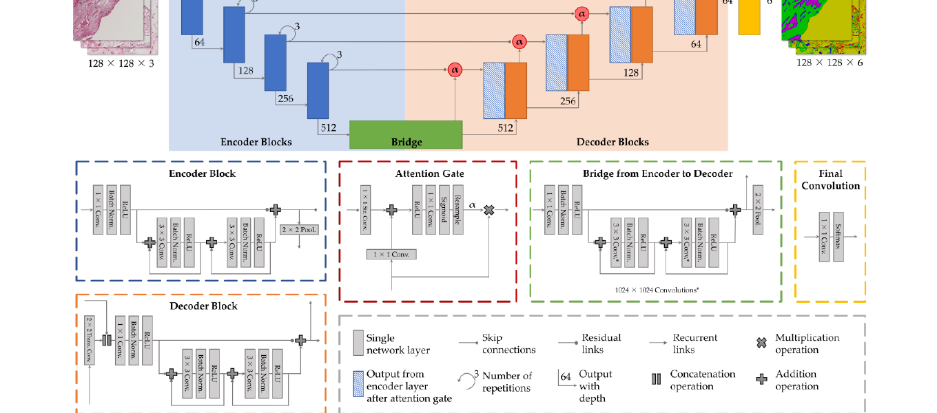 Architekturdiagramm aus dem Paper: vierstufiges U-Net mit Encoder-, Attention-Gate-, Bridge- und Decoder-Blöcken samt Legende